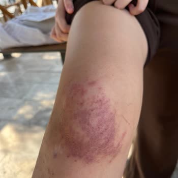 Tiamoo Premium Güzellik Cildimi Yaktılar Kabul Etmiyorlar