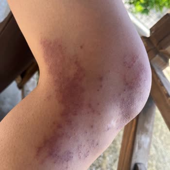 Tiamoo Premium Güzellik Cildimi Yaktılar Kabul Etmiyorlar