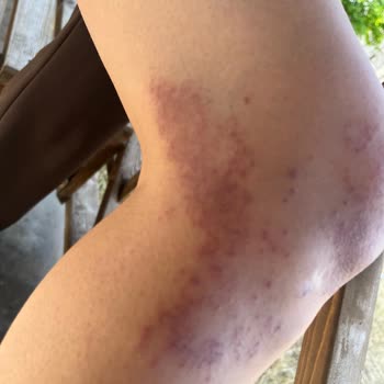 Tiamoo Premium Güzellik Cildimi Yaktılar Kabul Etmiyorlar