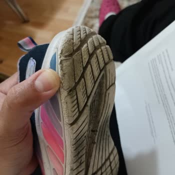 Yeni Alınan Çocuk Ayakkabısında Hızlı Deformasyon Ve Kullanıcı Hatası İddiası