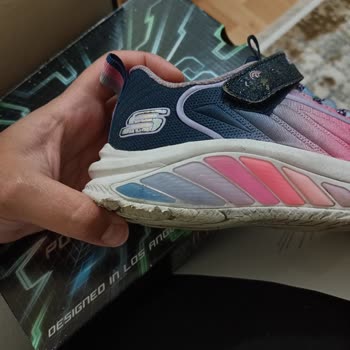 Yeni Alınan Çocuk Ayakkabısında Hızlı Deformasyon Ve Kullanıcı Hatası İddiası