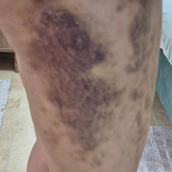 NN Beauty Vıp Sağlığımdan Etti