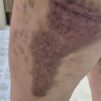 NN Beauty Vıp Sağlığımdan Etti