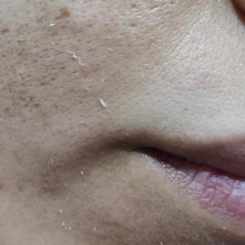 Bozuk Ürün Ve İlgisiz Müşteri Hizmetleri Nedeniyle Mağduriyet Yaşadım