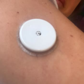 Freestyle Libre 2 Sensör Erken Uyarı Ve Ölçüm Sapmaları Tekrarlandı