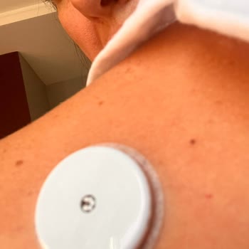 Freestyle Libre 2 Sensör Erken Uyarı Ve Ölçüm Sapmaları Tekrarlandı