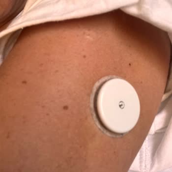 Freestyle Libre 2 Sensör Erken Uyarı Ve Ölçüm Sapmaları Tekrarlandı