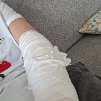 Otelde Yaşadığım Çay Kazası Sonrası İlgisizlik Ve Mağduriyet