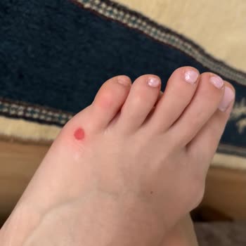 Tommy Hilfiger Sandalet Ayaklarımı Mahvetti İade Süresi Geçti