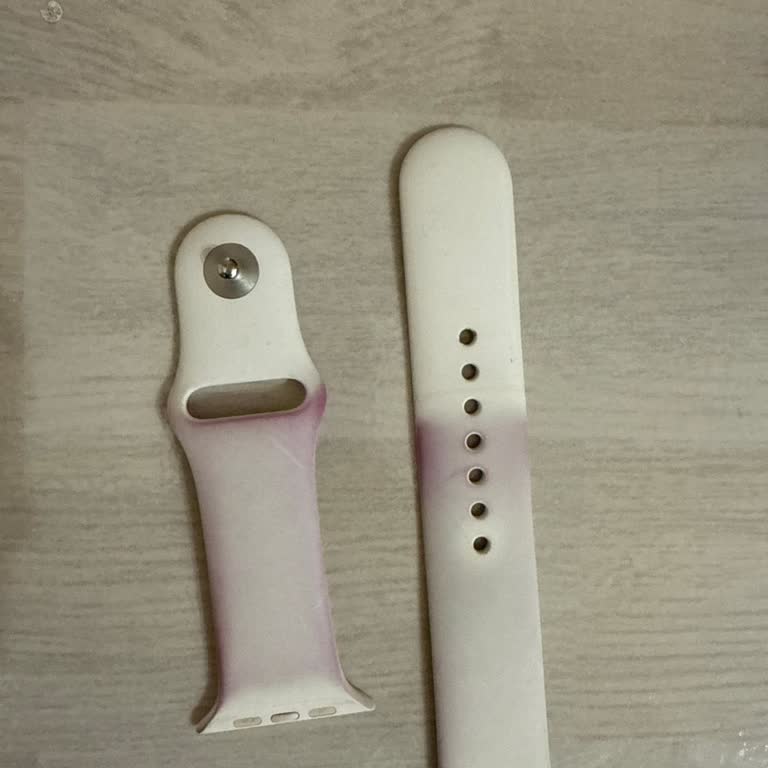 Apple Watch Kordonunda Renk Solması Ve Müşteri Hizmetleri Hayal Kırıklığı