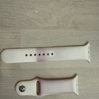 Apple Watch Kordonunda Renk Solması Ve Müşteri Hizmetleri Hayal Kırıklığı