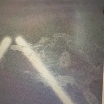 Zabunoğlu Otomotiv Sıfır Araç Tesliminde Beklenmedik Kaporta Lekeleri Ve Bayi Yaklaşımı