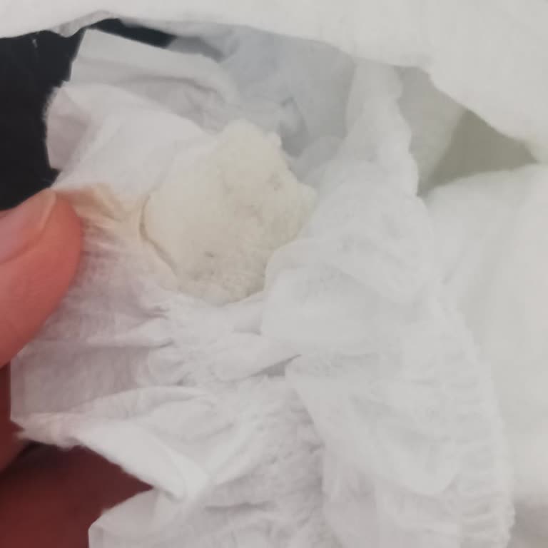 Molfix 6 Numara Bezde Yabancı Madde Ve Kalite Sorunu