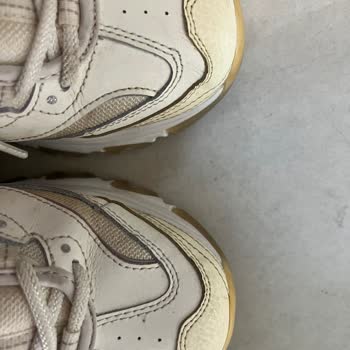 Skechers Ayakkabıda Hızlı Deformasyon Ve Yetersiz İnceleme Mağduriyeti