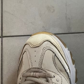 Skechers Ayakkabıda Hızlı Deformasyon Ve Yetersiz İnceleme Mağduriyeti