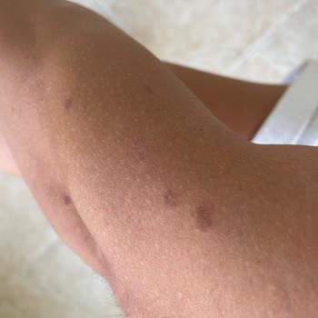 Seanslarım Çalındı, Hizmet Ve Personel Sürekli Değişiyor!