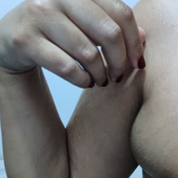 Buz Lazer Sonrası Artan Tüylenme Ve Sağlık Problemleri