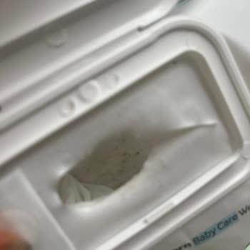 Aldığım Islak Mendiller Küflü Çıktı, Hayal Kırıklığına Uğradım