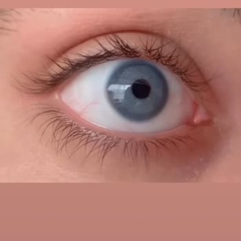 Aldığım Lens İle Gönderilen Lens Arasında Büyük Fark Yaşadım Çözüm Sunulmadı