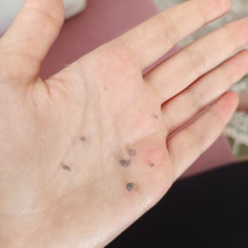 Neutrogena Yoğun Nemlendirici Ciltte Soyulma Ve Emilmemesi Sorunu