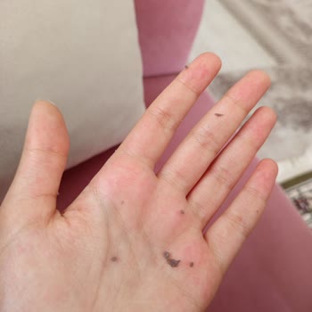 Neutrogena Yoğun Nemlendirici Ciltte Soyulma Ve Emilmemesi Sorunu