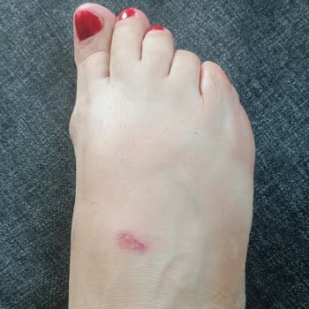 Aldığım Terlik Ayağımı Tahriş Etti, İade Sürecinde Mağdur Edildim