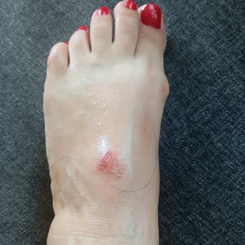 Aldığım Terlik Ayağımı Tahriş Etti, İade Sürecinde Mağdur Edildim