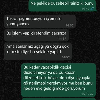 Başarısız Saç İşlemi Ve İlgisiz Hizmet