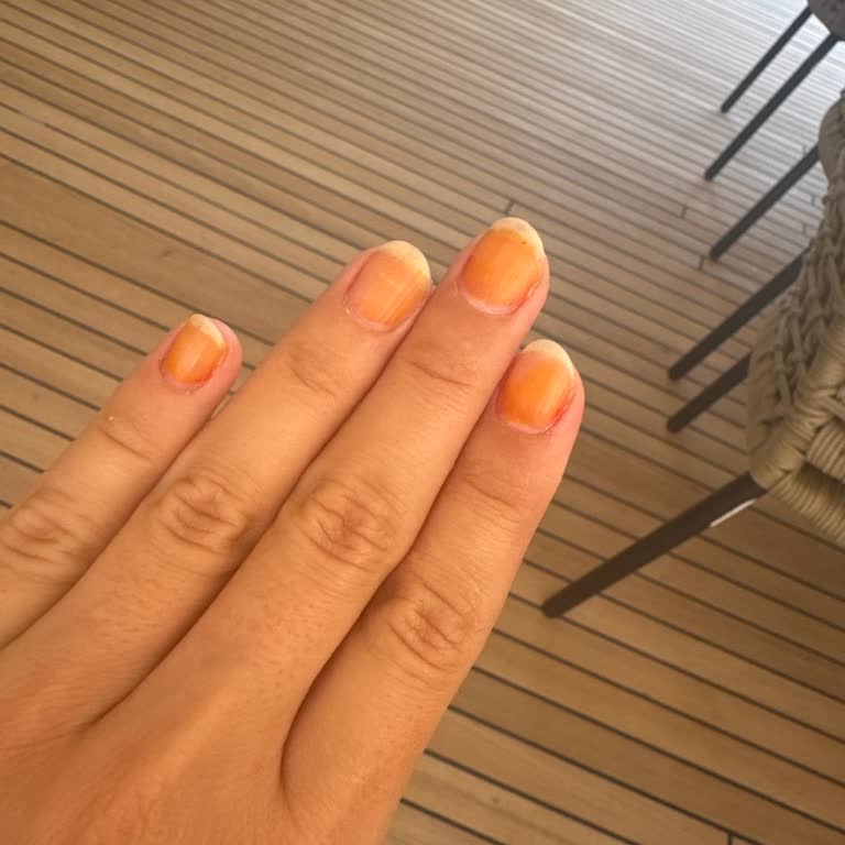 Flormar Oje Tırnaklarımı Turuncuya Boyadı, Tatilim Mahvoldu