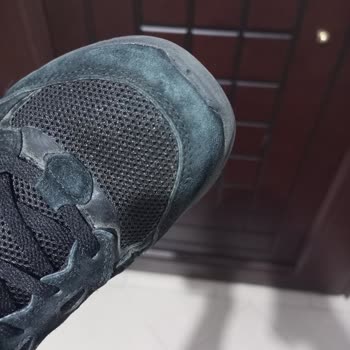 I Got No Support for My Skechers Shoes With Color Fading