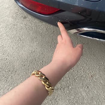 Yetkili Serviste Aracımın Zarar Görmesi Ve Mağduriyetimin Giderilmemesi