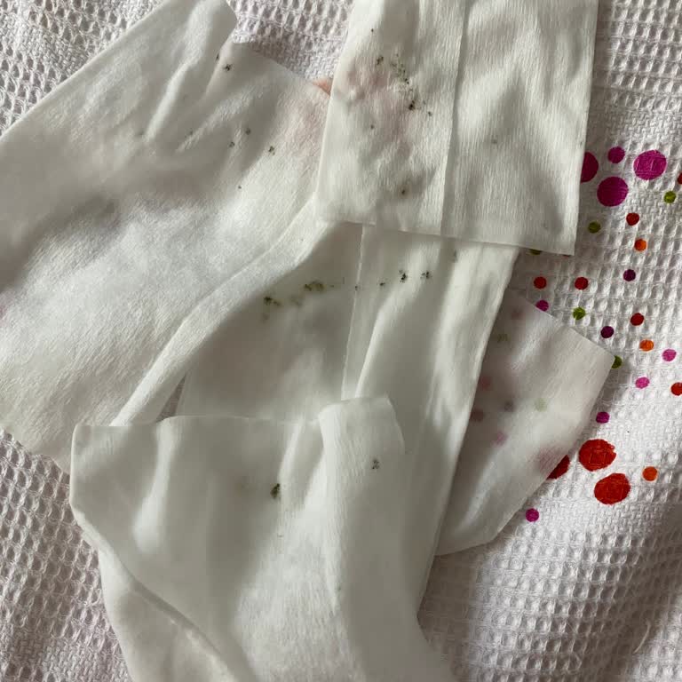 Sleepy Bio Natural Islak Mendil Küflü Çıktı: Hayal Kırıklığı Yaşadım