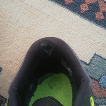 Adidas Ayakkabım 6 Ayda Yırtıldı, Gerekçesiz İade Edildi