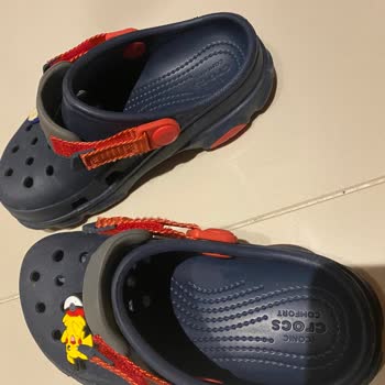Crocs Terlik Oğlumun Ayağında Yara Yaptı Beklenmedik Hayal Kırıklığı