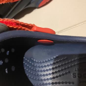 Crocs Terlik Oğlumun Ayağında Yara Yaptı Beklenmedik Hayal Kırıklığı