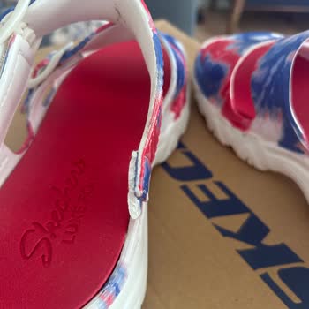 İkinci Kullanımda Kopan Sandalet İçin Yetersiz İnceleme Ve Mağduriyet