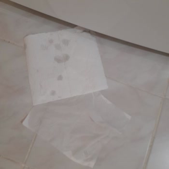 Arçelik Buzdolabında Tekrarlayan Su Akıtma Sorunu Ve Hayal Kırıklığı