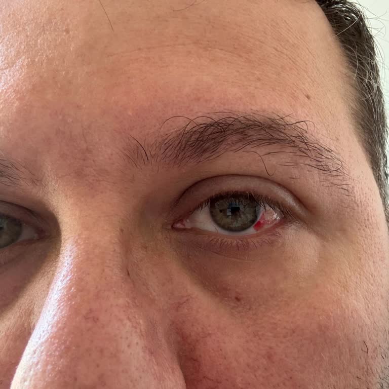 Dünya Göz Hastanesi Hatalı Bilgilendirme İle Onaylamadığım Ücretin Talep Edilmesi Mağduriyet Yarattı