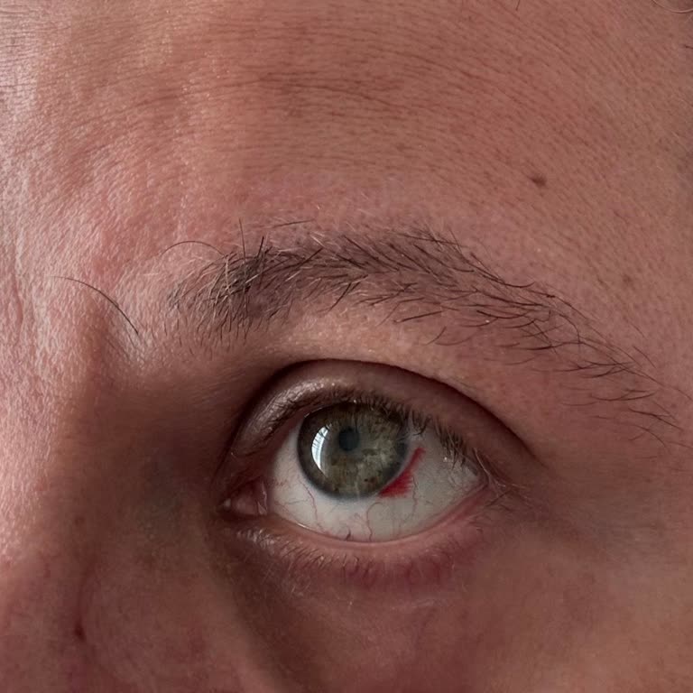 Dünya Göz Hastanesi Hatalı Bilgilendirme İle Onaylamadığım Ücretin Talep Edilmesi Mağduriyet Yarattı