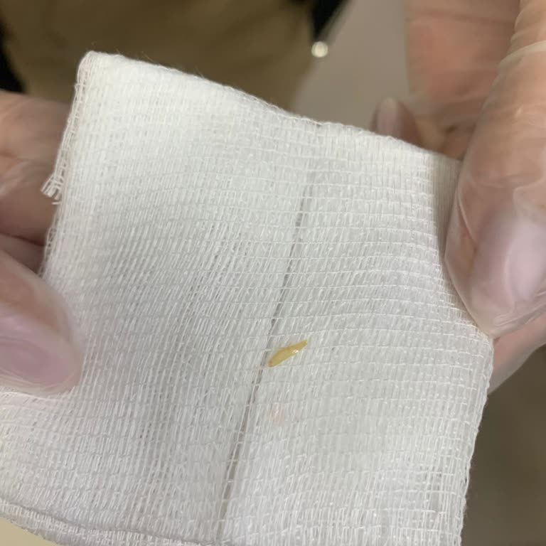 Bisküvide Yabancı Madde Çocuğumun Boğazına Battı Acile Gittik