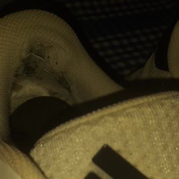Adidas Ayakkabının Kısa Sürede Yıpranıp Sağlığımı Olumsuz Etkilemesi