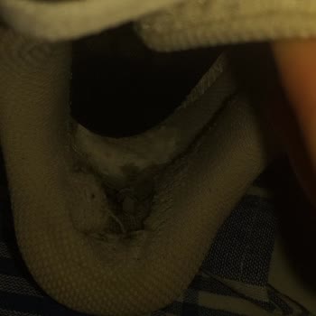 Adidas Ayakkabının Kısa Sürede Yıpranıp Sağlığımı Olumsuz Etkilemesi