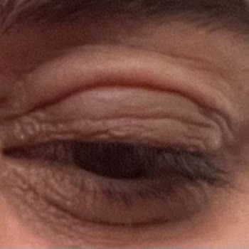 Ocean C Vitamini Alerji Yaptı, Sağlığımızı Riske Attı