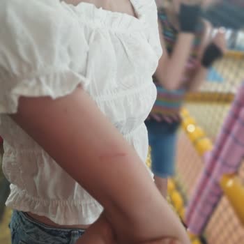 Art Gurme Coffee & Bistro Gerekli Önlemin Olmaması