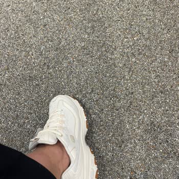 Skechers Aynı Model Ayakkabıda Yaşanan Kayma Ve İade Sorunu