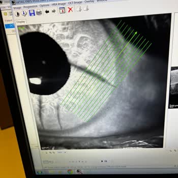 İstanbul Göz Merkezi (Fatih) Görme Oranımı %70'ten %10'lar Düşürdü