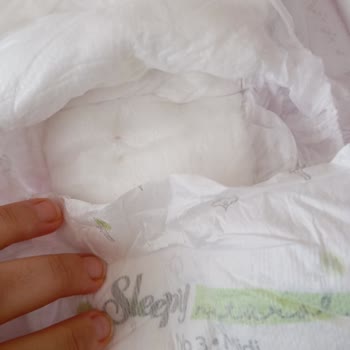 Sleepy 3 Numara Bezde Sert Ve Koyu Renkli Parçalar Sorunu