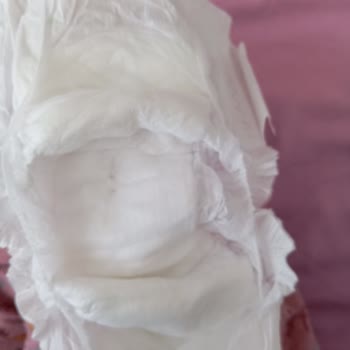 Sleepy 3 Numara Bezde Sert Ve Koyu Renkli Parçalar Sorunu