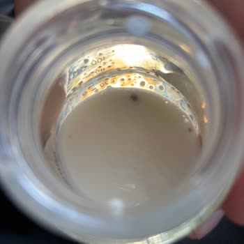 Bebek Mamasında Yabancı Cisimle Karşılaşmak Güvenimi Sarstı