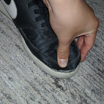 Kısa Sürede Deforme Olan Ayakkabı Ayağımı Yaraladı